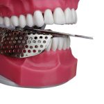 Impression Trays Adjustable - Image 3
