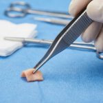 Tissue Forceps Toothed - Image 4