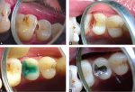 Maarc Pattern Wax - Image 5