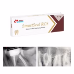 Maarc SmartSeal RCS Bioceramic Root Canal Sealing Material - Image 3