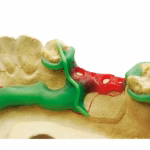 Maarc Clasp Profile Waxes - Image 6