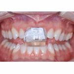 Maarc Eazy Tray 100gm - Image 7