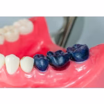 Maarc Inlay/Onlay Wax Sticks - Image 4