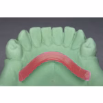 Maarc Lingual Bar Base Plate Wax - Image 5