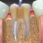 Maarc Sealmax+ - Image 5