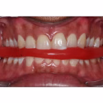 Maarc Modelling Wax Hard - 500g - Image 2