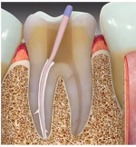 Maarc Rootfyx - Image 4