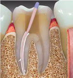 Maarc CeraSeal-B Sealer - Image 4
