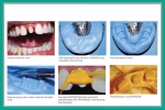 GC Flexceed Putty + Light Body Kit - Image 6